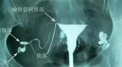 給高齡備孕女性的忠告：5個誤區(qū)，提前知道！